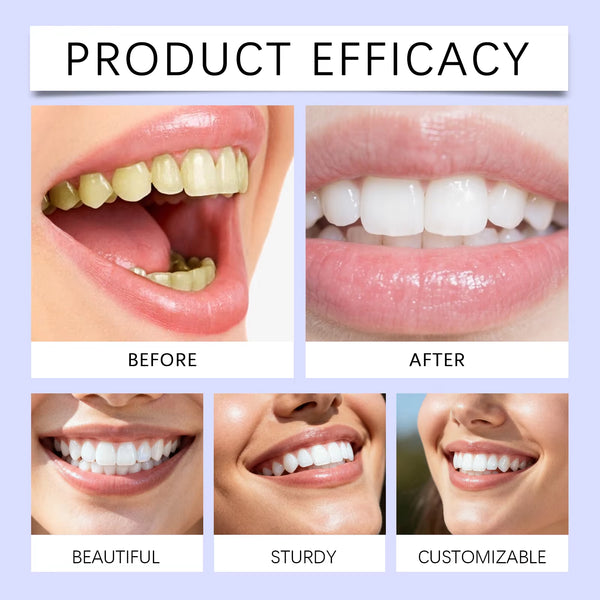Bright Smile Whitening Strips